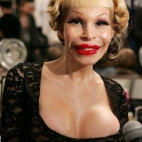 plastic surgery fail 11