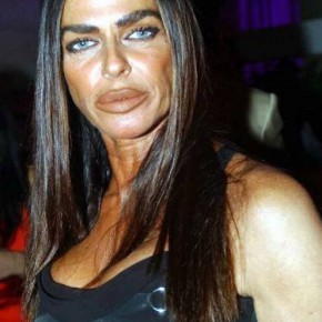 plastic surgery fail 12