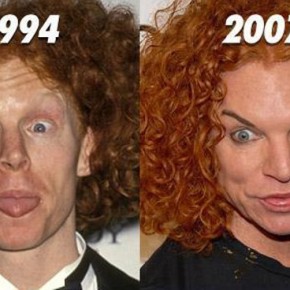 plastic surgery fail 15