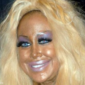 plastic surgery fail 21