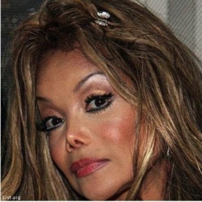 plastic surgery fail 22