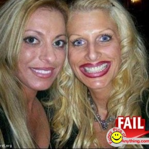 plastic surgery fail 6