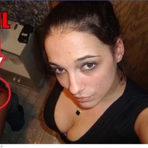 self shot epic fail q
